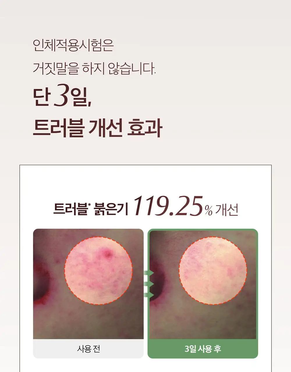 [1만5천원 사은품 한정수량][쿨링진정/대용량]블랑네이처 9배 고농축 어성초 토너 300ml 상세페이지 8